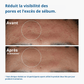 PureSkin™