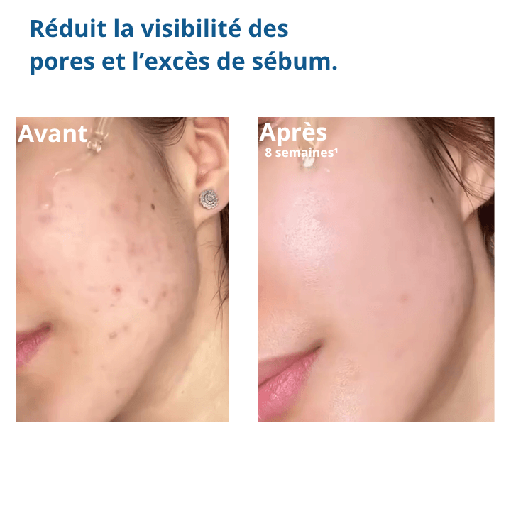 PureSkin™